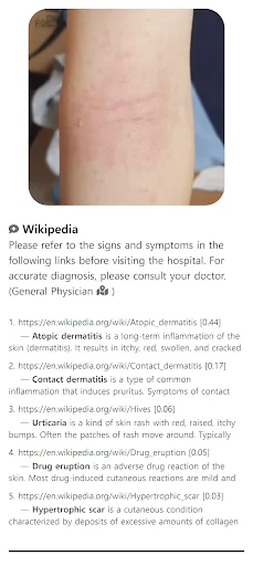 Model Dermatol डाउनलोड करें – स्किन डिजीज चेक और इमेज एटलस - Screenshot 7