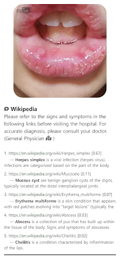 Model Dermatol डाउनलोड करें – स्किन डिजीज चेक और इमेज एटलस - Screenshot 8