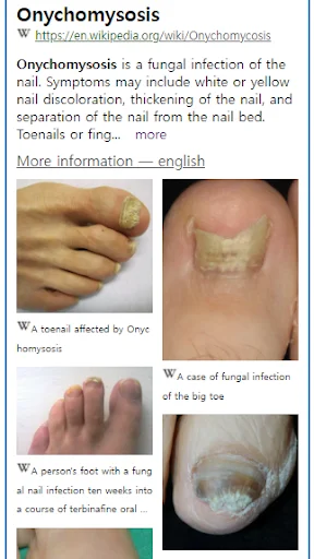Model Dermatol डाउनलोड करें – स्किन डिजीज चेक और इमेज एटलस - Screenshot 2