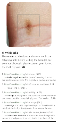 Model Dermatol डाउनलोड करें – स्किन डिजीज चेक और इमेज एटलस - Screenshot 4